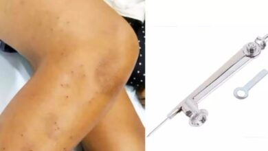 Big News in Indore : हैरान करने वाला मामला…! 4th कक्षा के छात्र पर 3 सहपाठियों ने किया ज्योमेट्री कंपास से 108 बार हमला…पैर हुआ छलनी